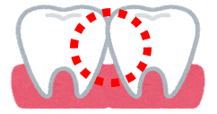 歯と歯茎の境目